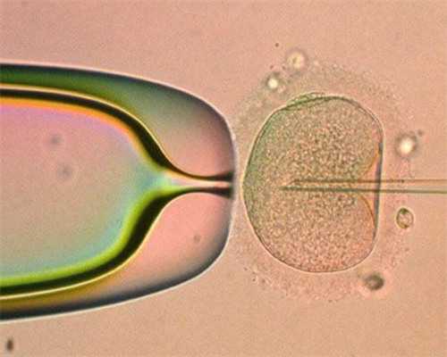 浙江借卵生子包生男孩选择指南：嘉兴妇保院与杭州邵逸夫医院对比分析